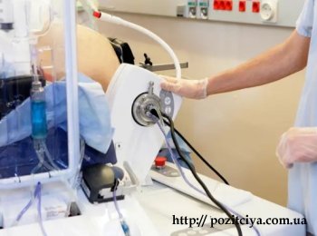 ���������� ����� ����: ���������� �� HIFU � ���������� ������ �������� ��� ��������