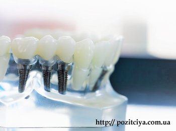 ���������� ����������� ������ ��������: �����, �������� �� ������� �������㳿